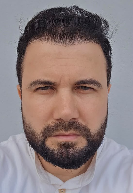 Kullanım sonrası